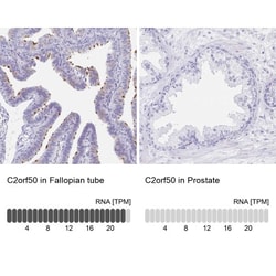 C2orf50 Antibody, Novus Biologicals 25 &mu;L, Unlabeled:Antibodies, Polyclonal